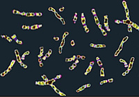 Chromosomes