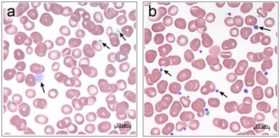 Platelets