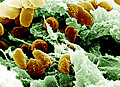 Yersinia pestis