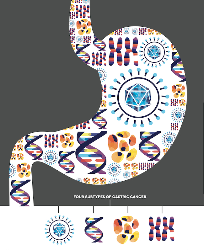 Four subtypes of gastric cancer. Credit: Allison Kudla/Ryo Sakai, Institute for Systems Biology