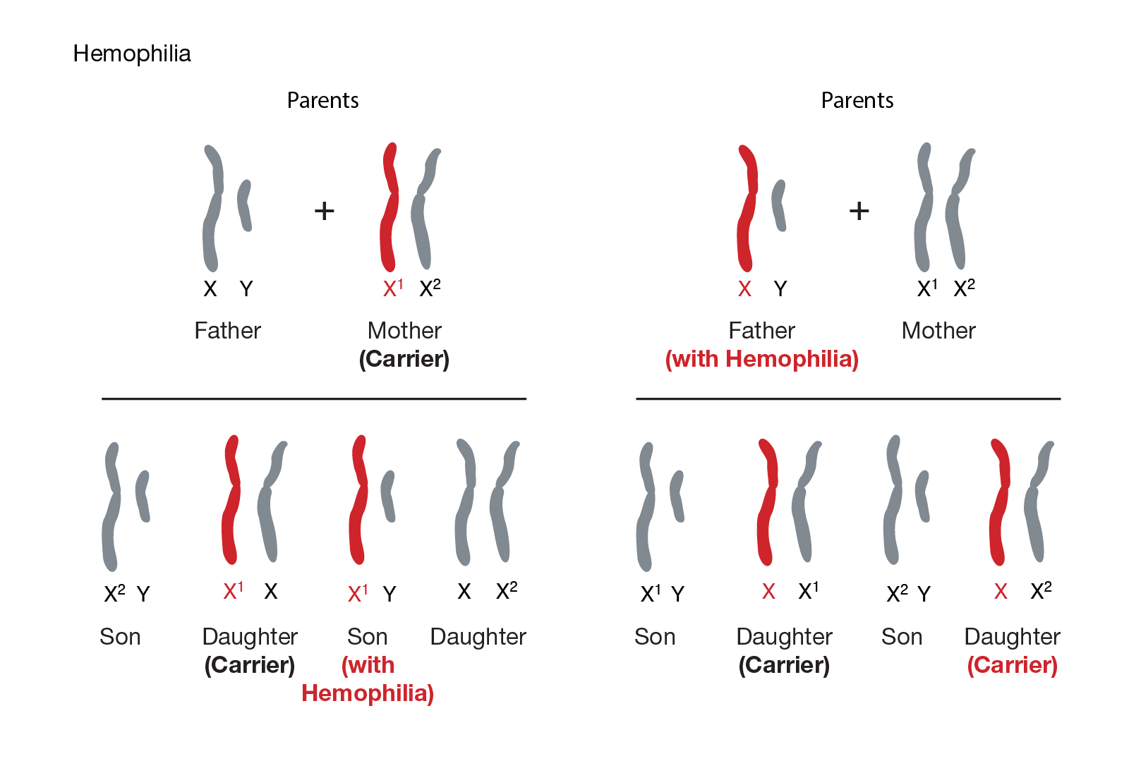  hemophilia